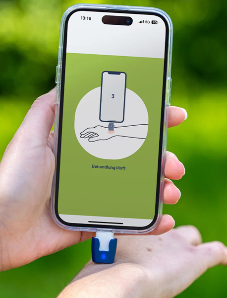 Heat It, mot insektsbett